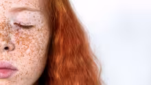 epiluminescenza videdermatoscopia centro medicobuonarroti su ragazza con lentiggini