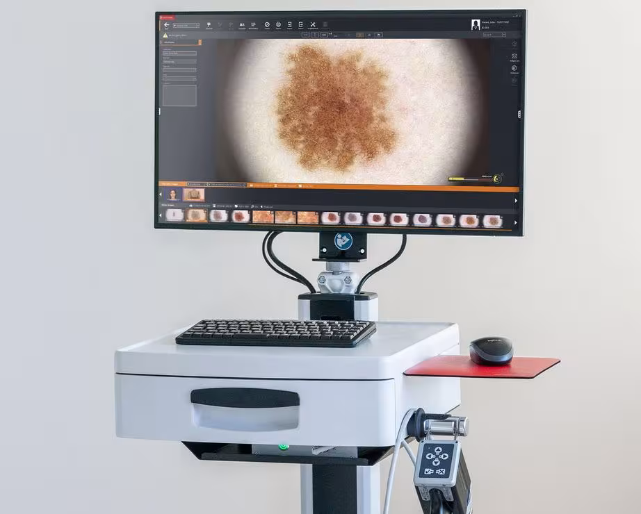 videodermatoscopio computerizzato digitale presso centro medico buonarroti